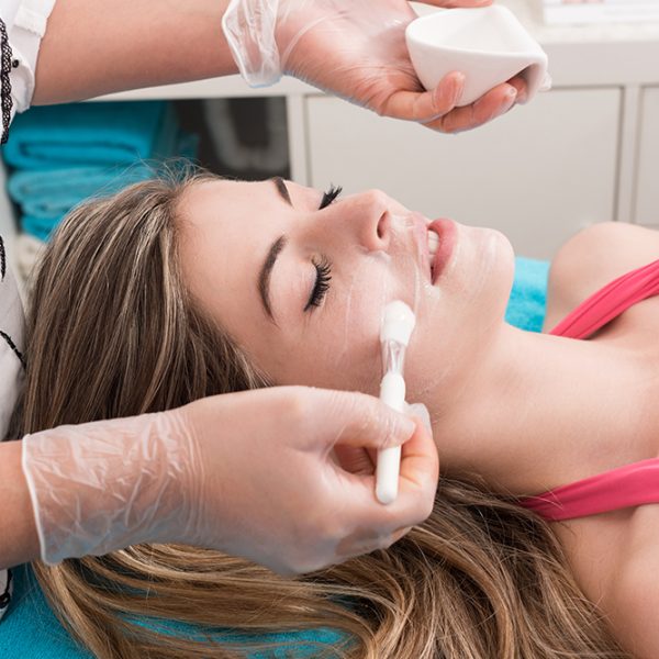 Chemical Peel