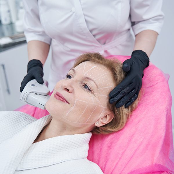 Non-surgical face lifting